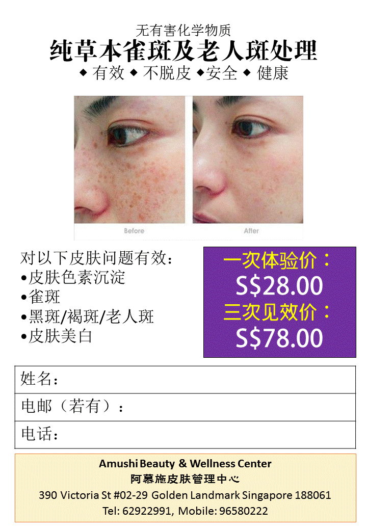 age spot removal in Singapore