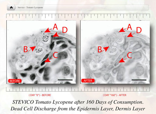 stevico tomato lycophene's effect on skin